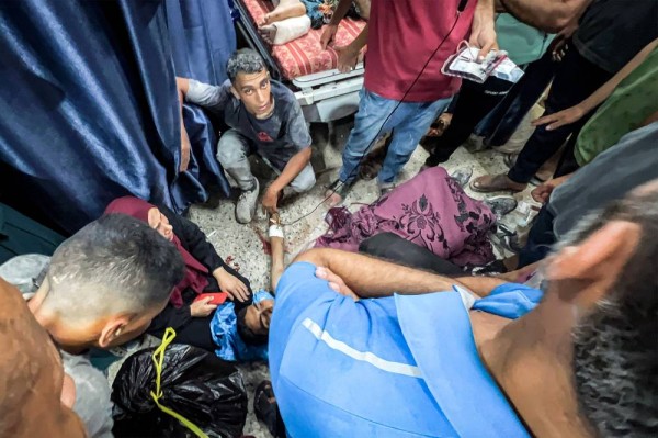 EDITORS NOTE: Graphic content / People gather around one of the victims injured while waiting for aid trucks entering the northern Gaza Strip through the Zikim crossing, as he lies on the floor at the Shifa Hospital in Gaza City on July 30, 2025. Gaza's civil defence agency said Israeli forces opened fire on July 30 on Palestinians waiting to collect humanitarian aid in the northern Gaza Strip, giving a preliminary death toll of 30. (Photo by Bashar TALEB / AFP)