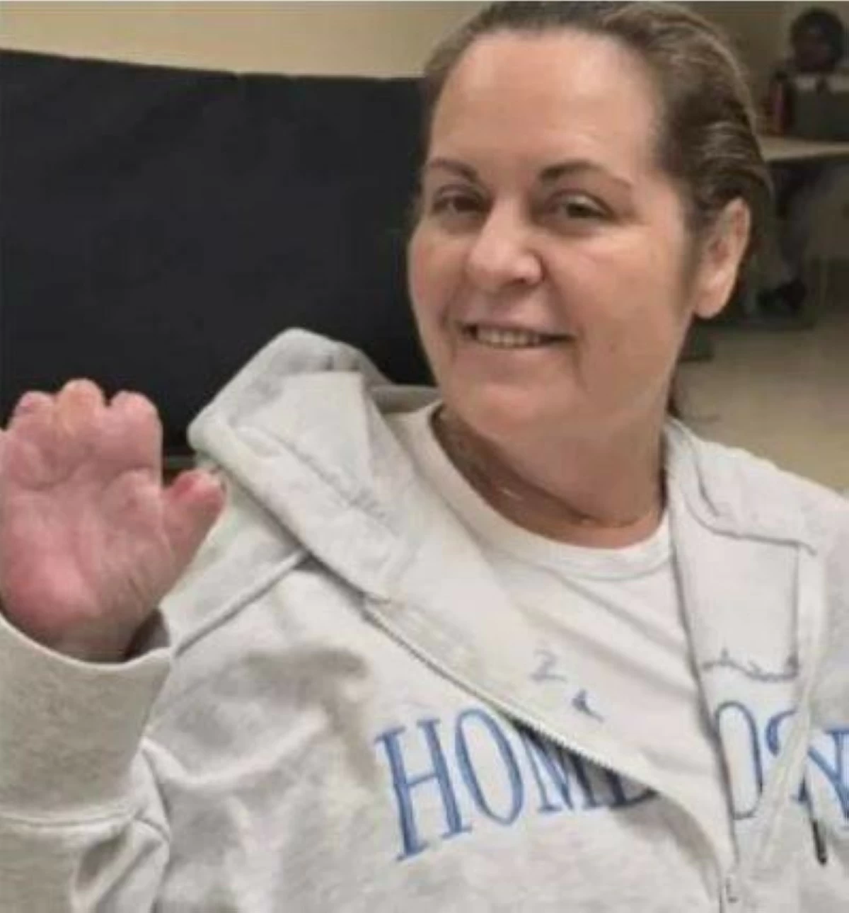 عالم الجريمة – الجراحة التجميلية تتسبب في بتر أطراف كندي