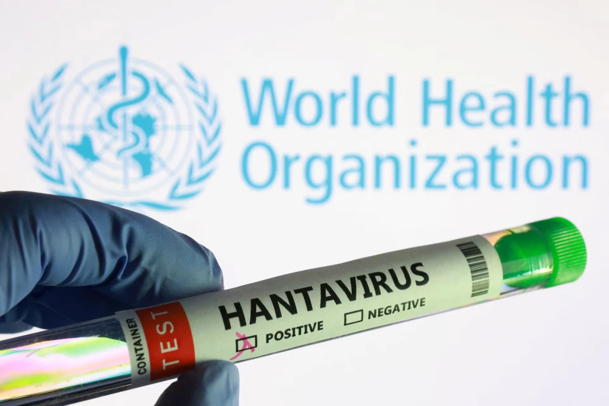 طب وصحة – منظمة الصحة العالمية تعلن ارتفاع عدد حالات الإصابة بفيروس هانتا إلى 13 شخصا
